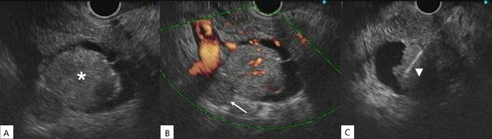 https://cdn.ncbi.nlm.nih.gov/pmc/blobs/fe7b/12175758/1b5fd6c5e1f9/toj-24-0115-figure1.jpg