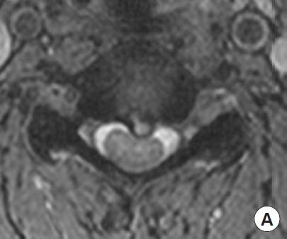 https://cdn.ncbi.nlm.nih.gov/pmc/blobs/fe7d/6790731/4910e473650b/ns-1938220-110f5.jpg