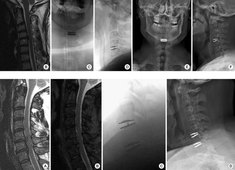 https://cdn.ncbi.nlm.nih.gov/pmc/blobs/fe7d/6790731/94b12f1f3ea8/ns-1938220-110f6.jpg