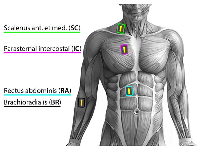 https://cdn.ncbi.nlm.nih.gov/pmc/blobs/fe81/10459781/d3645d1fa7f8/sensors-23-07200-g002.jpg