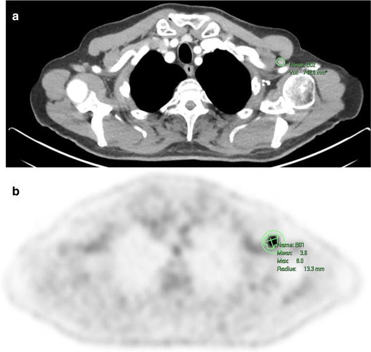 https://cdn.ncbi.nlm.nih.gov/pmc/blobs/fe81/8985565/0469bb584fe4/330_2022_8725_Fig1_HTML.jpg