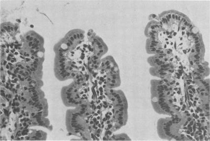 https://cdn.ncbi.nlm.nih.gov/pmc/blobs/fe85/263387/5f4d430d9aba/iai00130-0078-a.jpg