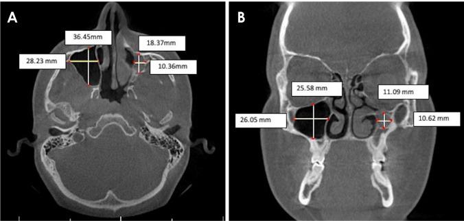 https://cdn.ncbi.nlm.nih.gov/pmc/blobs/fe85/7758263/7e7e4a6a514e/isd-50-365-g002.jpg