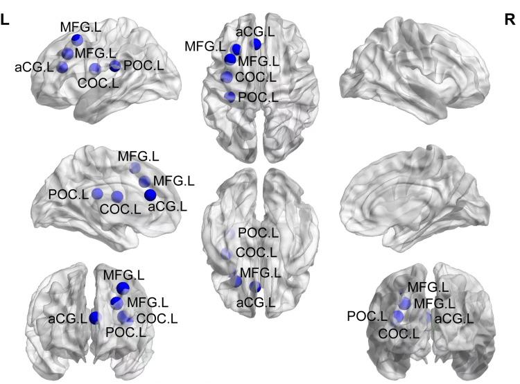https://cdn.ncbi.nlm.nih.gov/pmc/blobs/fe87/12103880/53ee1c212451/NSS-17-989-g0004.jpg