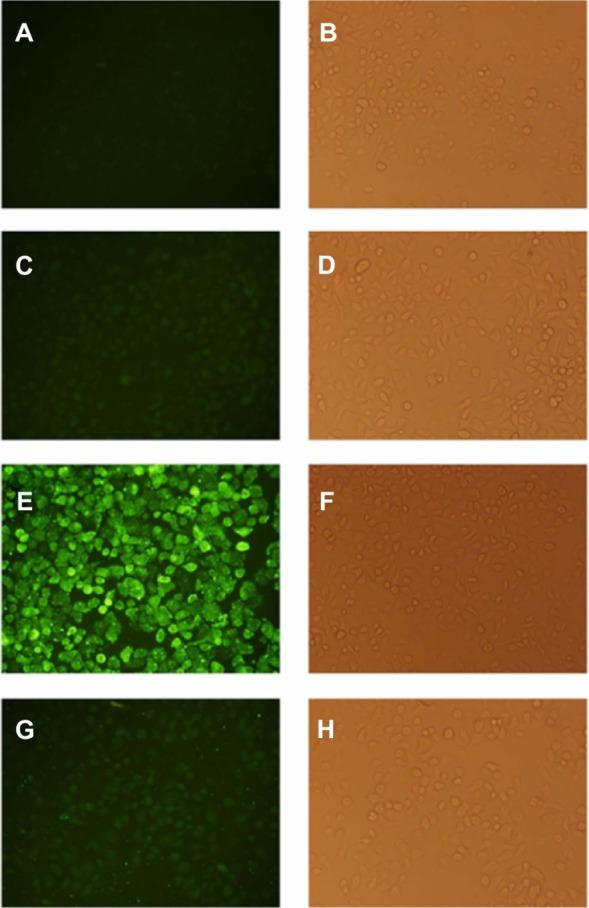 https://cdn.ncbi.nlm.nih.gov/pmc/blobs/fe8a/4019625/454425056c33/ijn-9-2167Fig6.jpg