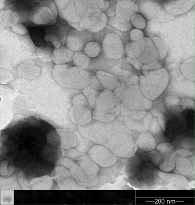 https://cdn.ncbi.nlm.nih.gov/pmc/blobs/fe8a/4019625/f13749e2c232/ijn-9-2167Fig2.jpg
