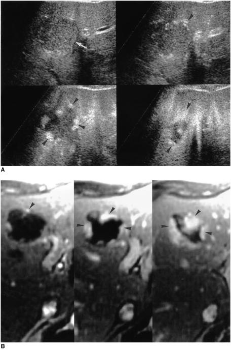 https://cdn.ncbi.nlm.nih.gov/pmc/blobs/fe91/2718200/39c9474ec19d/kjr-1-191-g012.jpg