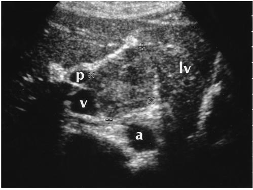 https://cdn.ncbi.nlm.nih.gov/pmc/blobs/fe91/2718200/494cb9127f89/kjr-1-191-g007.jpg