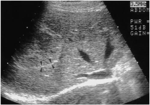https://cdn.ncbi.nlm.nih.gov/pmc/blobs/fe91/2718200/8aa50ff1b21e/kjr-1-191-g002.jpg