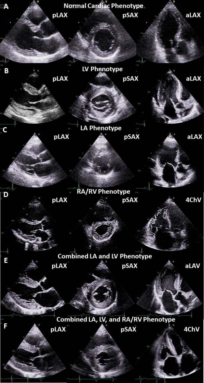 https://cdn.ncbi.nlm.nih.gov/pmc/blobs/fe93/9849322/a9c4a2d63a15/392_2022_2041_Fig2_HTML.jpg