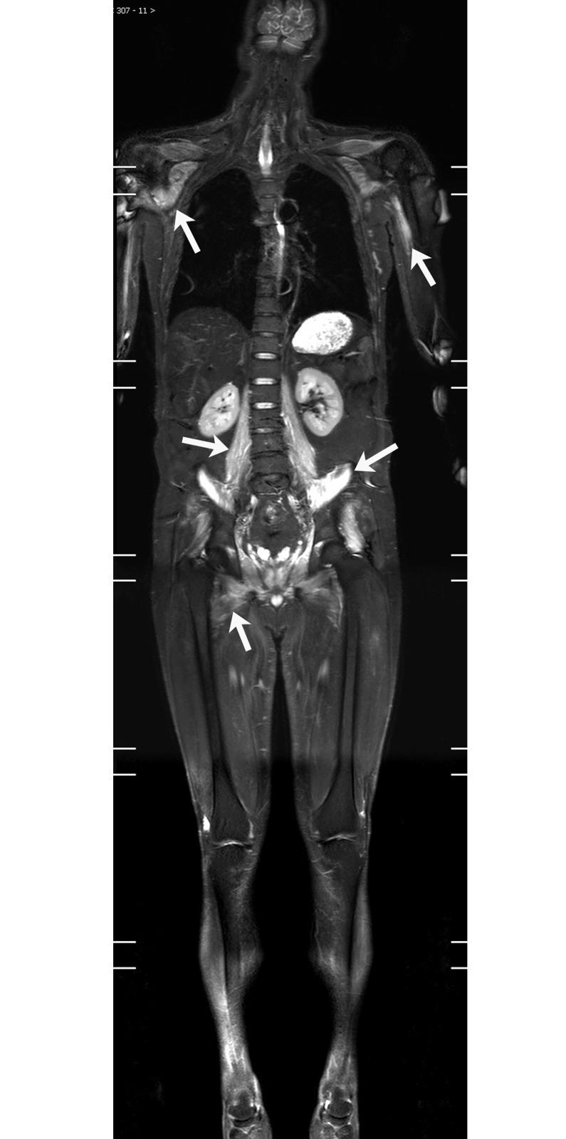 https://cdn.ncbi.nlm.nih.gov/pmc/blobs/fe9b/5513424/7b28819a227a/pone.0181069.g001.jpg
