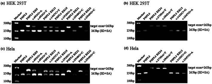 https://cdn.ncbi.nlm.nih.gov/pmc/blobs/fe9d/10094094/e009cd4146ab/MGG3-11-e2128-g003.jpg