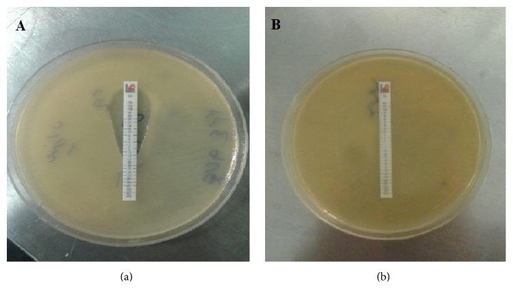 https://cdn.ncbi.nlm.nih.gov/pmc/blobs/feaa/5540380/6d53d6beb5c5/BMRI2017-7157923.001.jpg