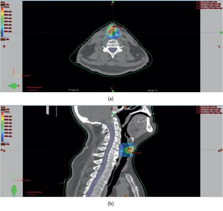 https://cdn.ncbi.nlm.nih.gov/pmc/blobs/feac/6874992/6cf73793da1b/JO2019-8640549.002.jpg
