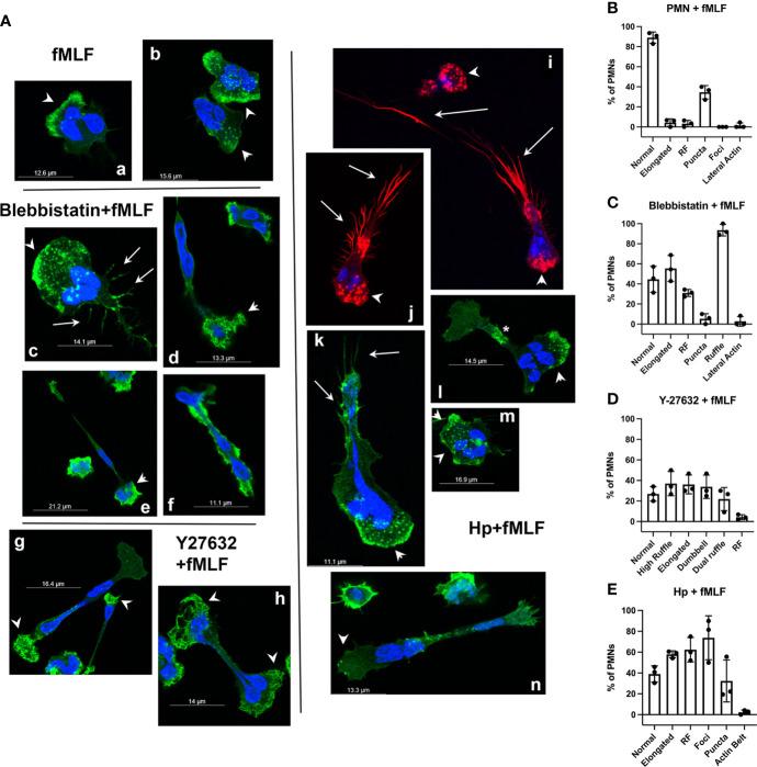https://cdn.ncbi.nlm.nih.gov/pmc/blobs/feb0/9630475/497ee82b492a/fimmu-13-1038349-g007.jpg