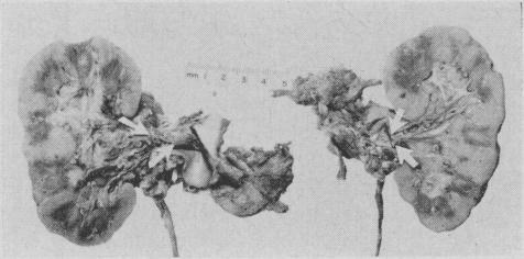 https://cdn.ncbi.nlm.nih.gov/pmc/blobs/feb4/1848480/c65a719c78c9/canmedaj00915-0008-a.jpg