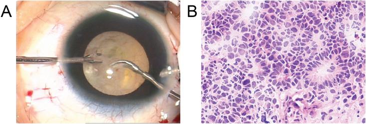 https://cdn.ncbi.nlm.nih.gov/pmc/blobs/feb5/5722165/b57e9240c8ef/gr3.jpg