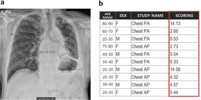 https://cdn.ncbi.nlm.nih.gov/pmc/blobs/feb6/10148851/8f7a680fc2f9/41746_2023_829_Fig3_HTML.jpg