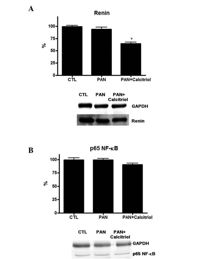 https://cdn.ncbi.nlm.nih.gov/pmc/blobs/feb9/4438961/958a5f41eb1c/MMR-12-01-1009-g04.jpg