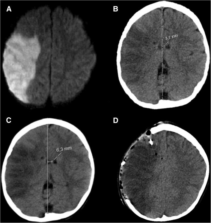 https://cdn.ncbi.nlm.nih.gov/pmc/blobs/fec0/6556035/c575b80d7362/13054_2019_2490_Fig10_HTML.jpg