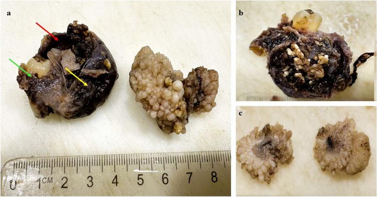 https://cdn.ncbi.nlm.nih.gov/pmc/blobs/fec1/11520492/b55a55b01760/13000_2024_1560_Fig3_HTML.jpg