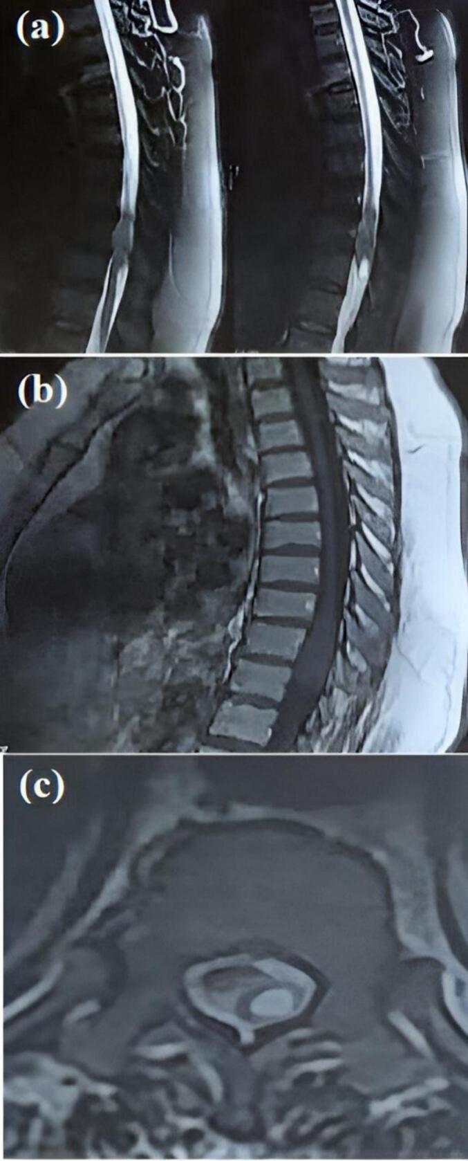https://cdn.ncbi.nlm.nih.gov/pmc/blobs/fec2/10937843/86ba4d017307/gr1.jpg