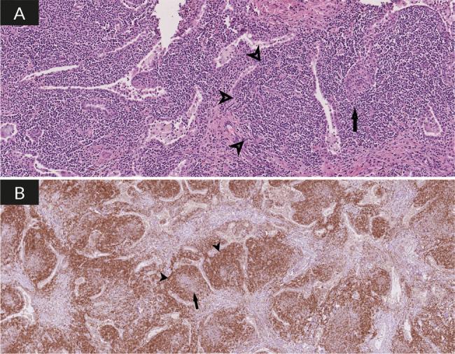 https://cdn.ncbi.nlm.nih.gov/pmc/blobs/fec5/11716307/c6ee29de29d7/4997_Fig2.jpg