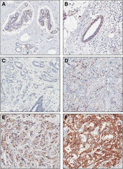 https://cdn.ncbi.nlm.nih.gov/pmc/blobs/fec5/3306846/1e62c34c6b51/bjc201211f1.jpg