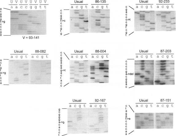 https://cdn.ncbi.nlm.nih.gov/pmc/blobs/fec6/1918356/261684569cfb/ajhg00041-0058-a.jpg