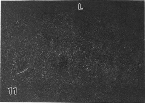 https://cdn.ncbi.nlm.nih.gov/pmc/blobs/fece/1260001/5c6a45ff539c/janat00139-0194-c.jpg