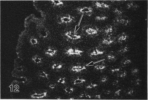https://cdn.ncbi.nlm.nih.gov/pmc/blobs/fece/1260001/6701a317613f/janat00139-0194-d.jpg
