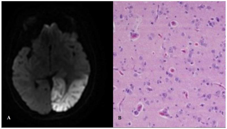 https://cdn.ncbi.nlm.nih.gov/pmc/blobs/fedf/8002645/3b0bdd3f8fac/jcm-10-01249-g002.jpg
