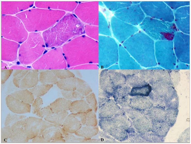 https://cdn.ncbi.nlm.nih.gov/pmc/blobs/fedf/8002645/7449e81a132f/jcm-10-01249-g001.jpg