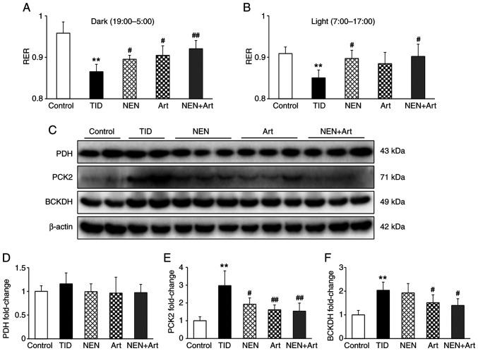 https://cdn.ncbi.nlm.nih.gov/pmc/blobs/fee3/8815055/08ba095c9608/etm-23-03-11164-g05.jpg