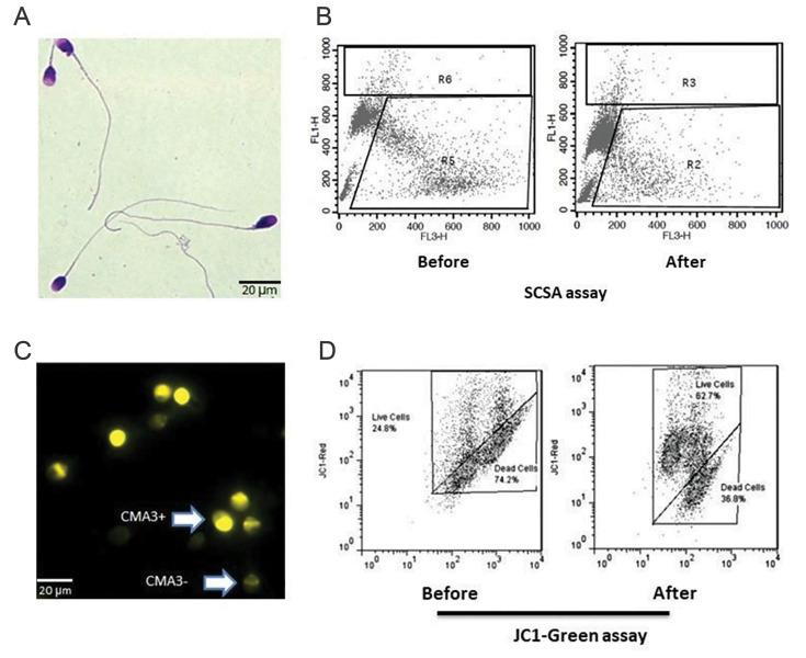 https://cdn.ncbi.nlm.nih.gov/pmc/blobs/fee5/9617023/c728e9ead503/Cell-J-24-603-g02.jpg