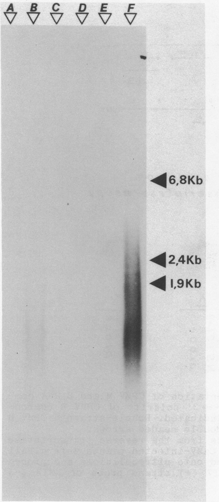 https://cdn.ncbi.nlm.nih.gov/pmc/blobs/fee9/321806/c2c2061eb089/nar00306-0347-a.jpg