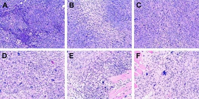 https://cdn.ncbi.nlm.nih.gov/pmc/blobs/feea/6304248/d92a47e4587f/ijn-14-075Fig8.jpg