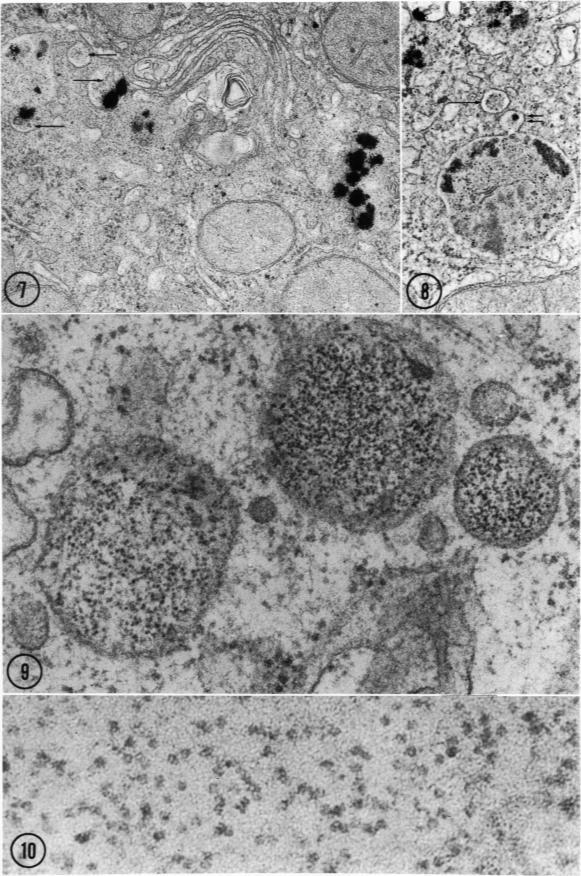 https://cdn.ncbi.nlm.nih.gov/pmc/blobs/fef2/2032849/07c0336a7ee8/amjpathol00572-0084-a.jpg