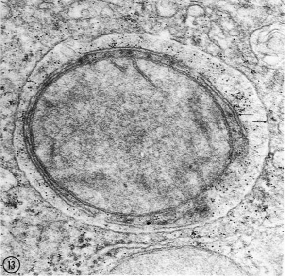 https://cdn.ncbi.nlm.nih.gov/pmc/blobs/fef2/2032849/d10b178760ed/amjpathol00572-0088-b.jpg