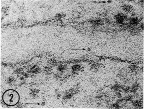https://cdn.ncbi.nlm.nih.gov/pmc/blobs/fef2/2032849/db967fe4866e/amjpathol00572-0080-b.jpg