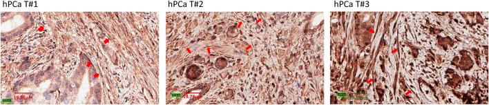 https://cdn.ncbi.nlm.nih.gov/pmc/blobs/fef7/10995317/4e618267e296/fmolb-11-1354076-g007.jpg