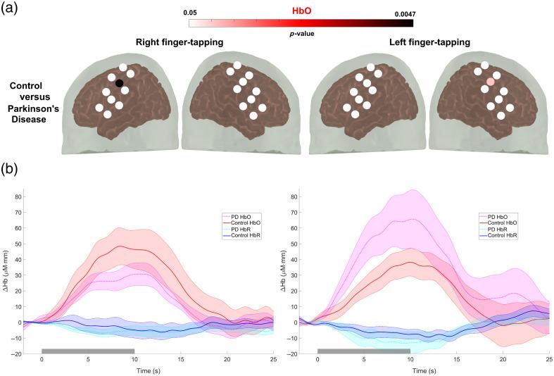 https://cdn.ncbi.nlm.nih.gov/pmc/blobs/fefe/11135928/37243a32c78b/NPh-011-025004-g004.jpg