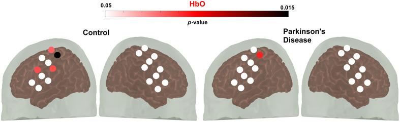 https://cdn.ncbi.nlm.nih.gov/pmc/blobs/fefe/11135928/9d9a135a7f64/NPh-011-025004-g006.jpg