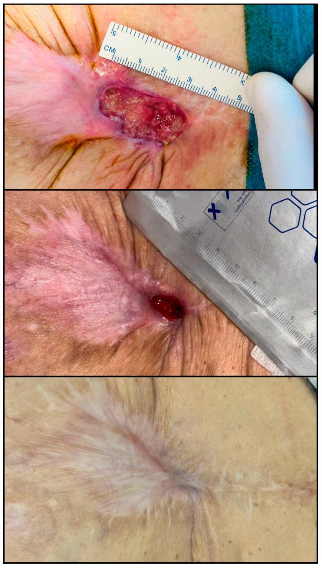 https://cdn.ncbi.nlm.nih.gov/pmc/blobs/ff04/12383684/bb2e7507083a/biomedicines-13-01827-g007.jpg