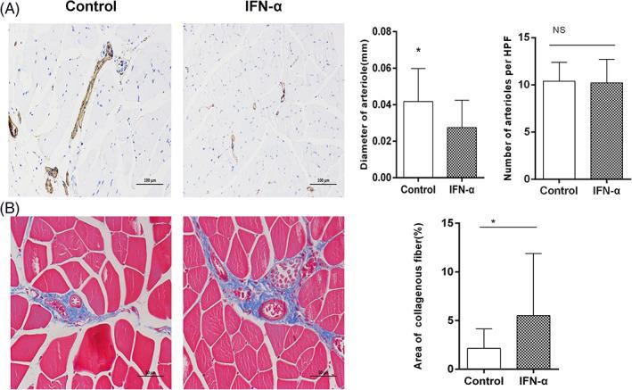https://cdn.ncbi.nlm.nih.gov/pmc/blobs/ff0c/8571556/3ab9d2e0c3d9/CLC-44-1621-g004.jpg