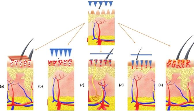 https://cdn.ncbi.nlm.nih.gov/pmc/blobs/ff1c/8325649/f6d5e9516d93/10856_2021_6559_Fig5_HTML.jpg