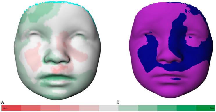 https://cdn.ncbi.nlm.nih.gov/pmc/blobs/ff24/10607132/062ca9e78605/jcm-12-06432-g003.jpg