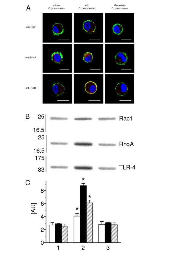 https://cdn.ncbi.nlm.nih.gov/pmc/blobs/ff34/1180473/052f2de70e14/1465-9921-6-51-7.jpg