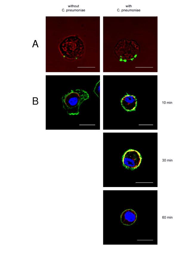 https://cdn.ncbi.nlm.nih.gov/pmc/blobs/ff34/1180473/0d2e0b6949ef/1465-9921-6-51-3.jpg