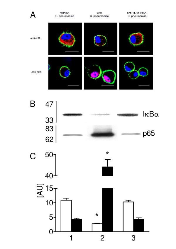 https://cdn.ncbi.nlm.nih.gov/pmc/blobs/ff34/1180473/75ac689fb5b1/1465-9921-6-51-5.jpg